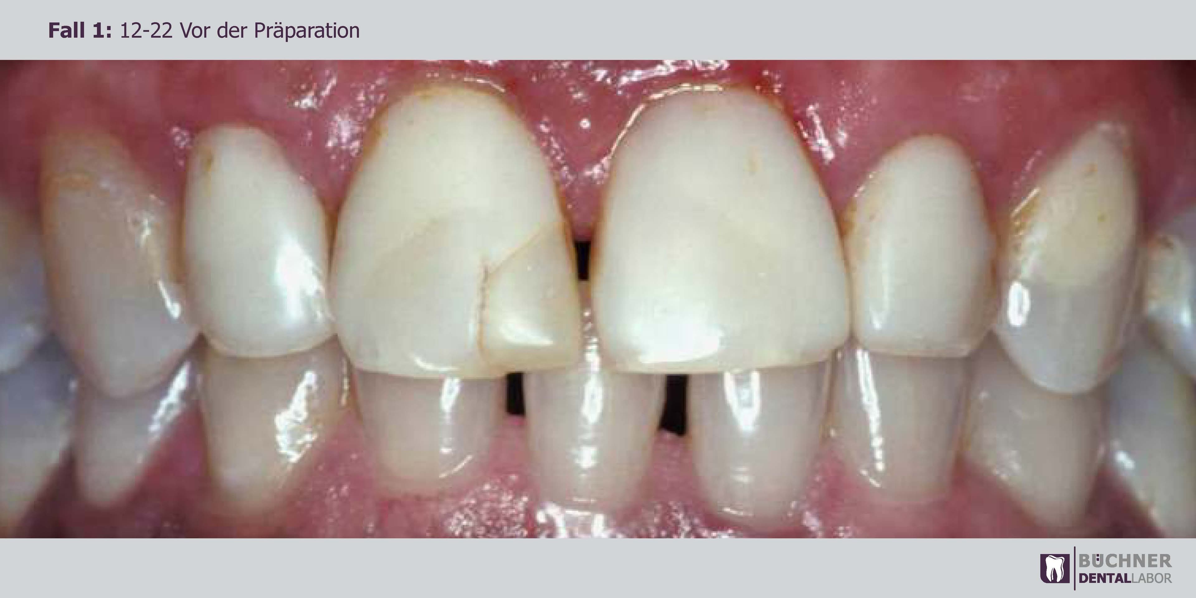 Dentallabor Arbeit 1