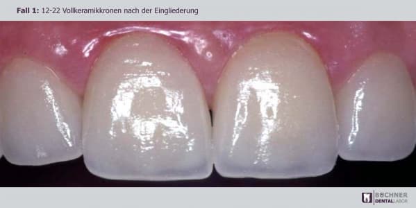 Dentallabor Arbeit 2