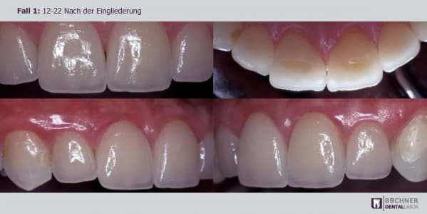 Dentallabor Arbeit 3