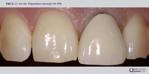 Dentallabor Arbeit 4