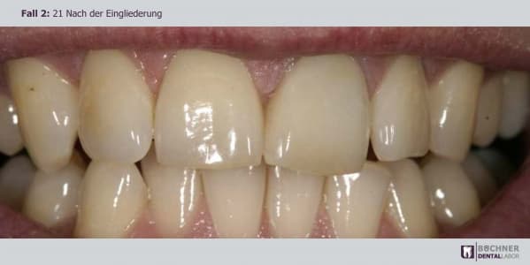 Dentallabor Arbeit 5