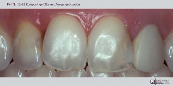 Dentallabor Arbeit 6