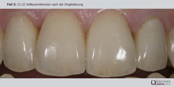 Dentallabor Arbeit 7