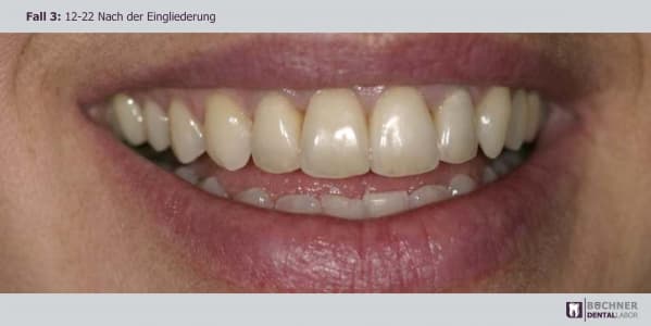 Dentallabor Arbeit 8
