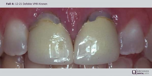 Dentallabor Arbeit 9