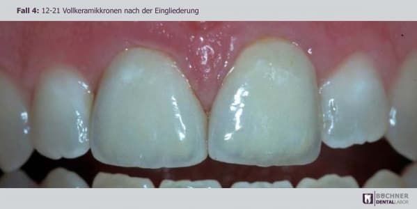 Dentallabor Arbeit 10