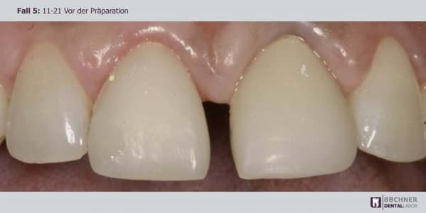 Dentallabor Arbeit 11