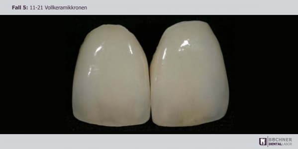 Dentallabor Arbeit 12