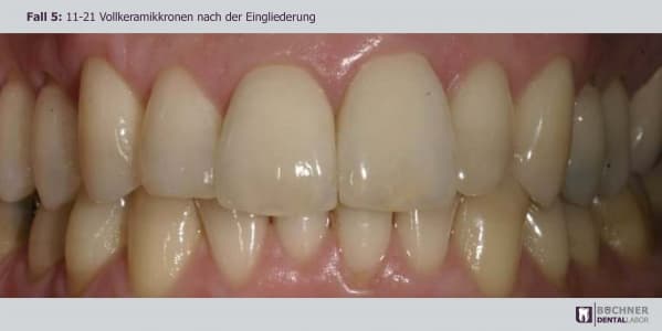 Dentallabor Arbeit 13